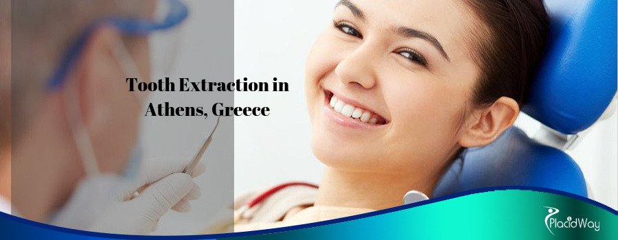 Tooth Extraction in Athens, Greece